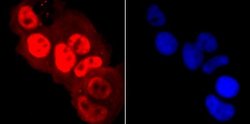 RNA Polymerase II/POLR2A (ac Ser5) Rabbit anti-Human, Mouse, Rat, Clone: